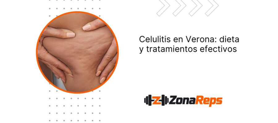 Celulitis en Verona: dieta y tratamientos efectivos